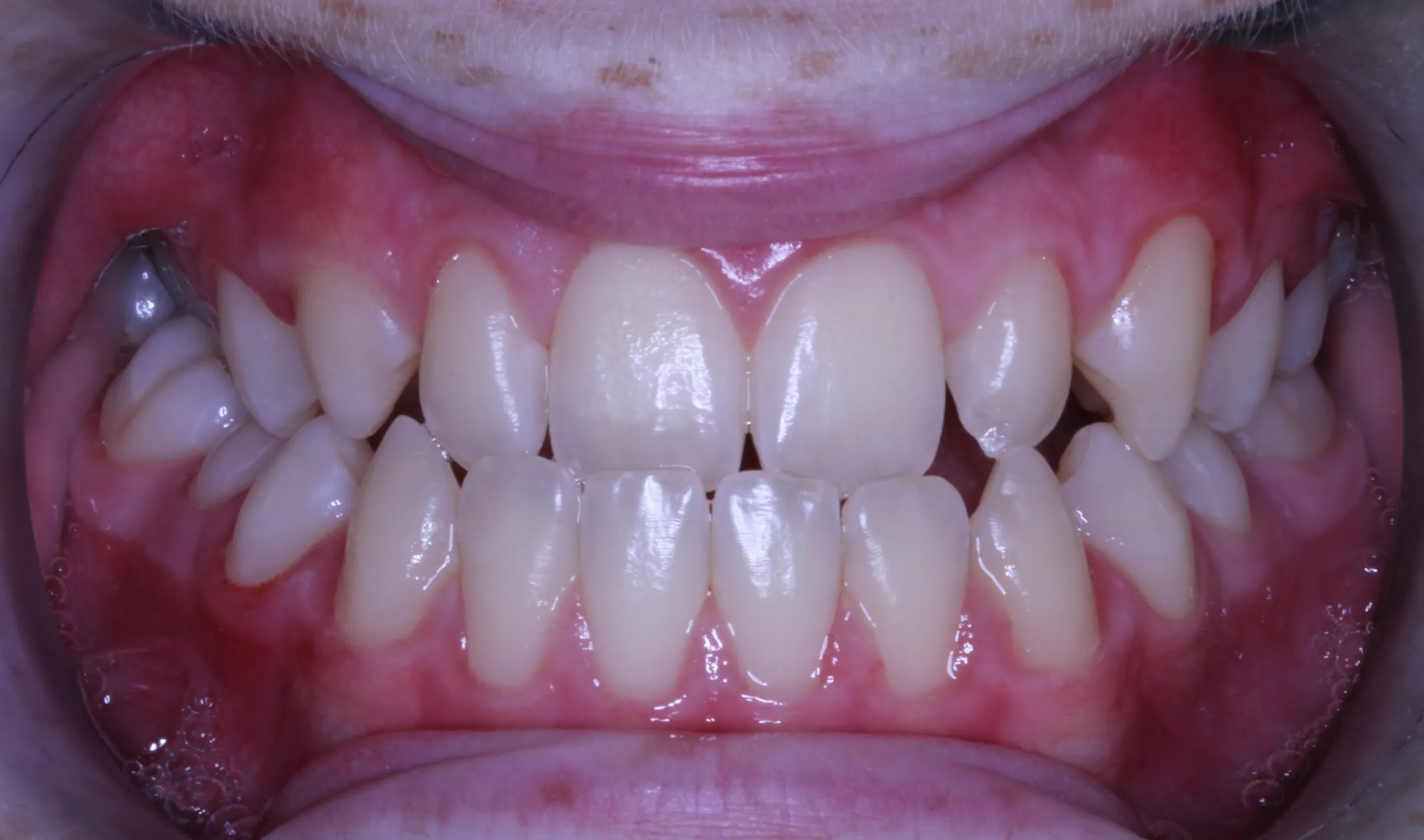 smile-gallery gallery